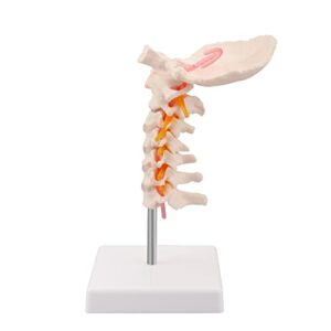 Ultrassist Cervical Spine Model with Cervical Vertebrae, Cervical Nerves, Vertebral Arteries & Occipital Plate for Medical Education