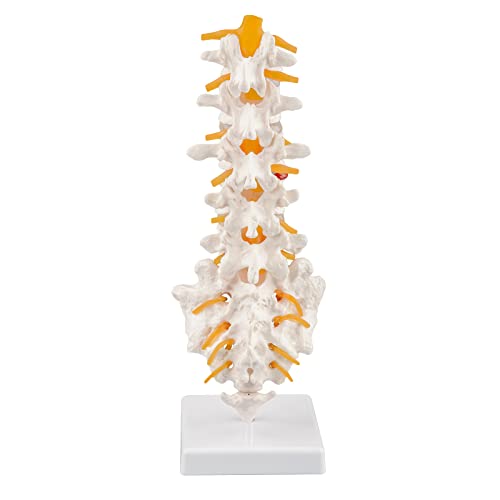 Ultrassist Human Spine Model with 5 Lumbar Vertebrae, Herniation Discs, Lumbar Nerves and Spinal Cord for Medical Teaching