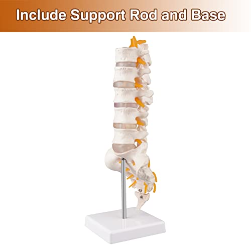 Ultrassist Human Spine Model with 5 Lumbar Vertebrae, Herniation Discs, Lumbar Nerves and Spinal Cord for Medical Teaching