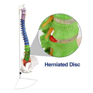 Ultrassist Life Size Human Spine Model, 34" Flexible Spinal Cord with Hyoid Bone, Herniated disk, Nerves, Arteries and Colored Vertebrae, Ideal Educational Model for Medical Students and Chiropractors