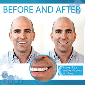 Instant Smile Complete Your Smile Temporary Tooth Replacement Kit - Replace a Missing Tooth in Minutes - Patented