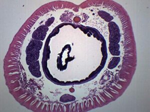 earthworm setae, cross section - prepared microscope slide - 75 x 25mm - biology & microscopy - eisco labs
