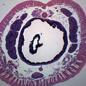 Earthworm Setae, Cross Section - Prepared Microscope Slide - 75 x 25mm - Biology & Microscopy - Eisco Labs