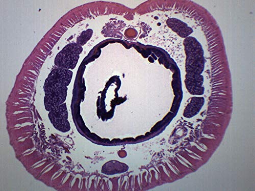 Earthworm Setae, Cross Section - Prepared Microscope Slide - 75 x 25mm - Biology & Microscopy - Eisco Labs