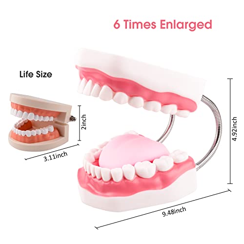 Ultrassist Mouth Model Metal Hinge for Speech Therapy, Ideal Brushing Teaching Dental Teeth Model for Kids and Children, 6 Times Enlarge, Includes Toothbrush