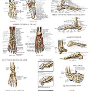 Palace Learning 2 Pack - Anatomy and Injuries of the Hand & Wrist + Anatomy and Injuries of the Foot & Ankle - Set of 2 Anatomical Charts - Laminated 18" x 24"