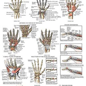 Laminated Anatomy and Injuries of the Hand and Wrist Poster - Hand and Wrist Joint Anatomical Chart - 18" x 24"