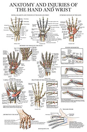 Laminated Anatomy and Injuries of the Hand and Wrist Poster - Hand and Wrist Joint Anatomical Chart - 18" x 24"