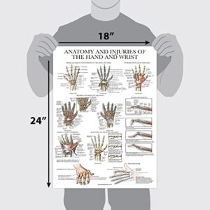 Laminated Anatomy and Injuries of the Hand and Wrist Poster - Hand and Wrist Joint Anatomical Chart - 18" x 24"