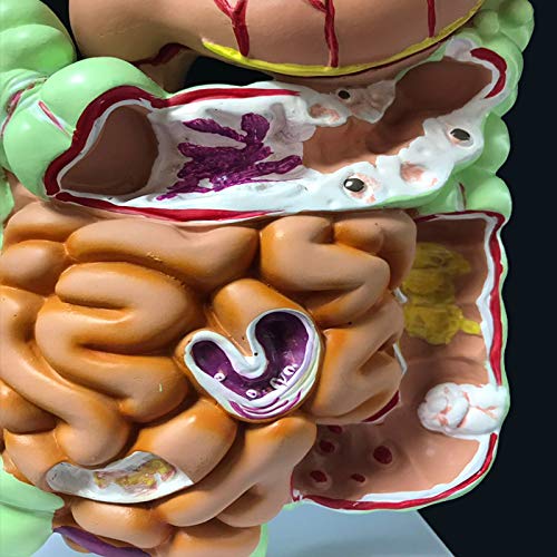 Human Digestive System Stomach Anatomy Model The Large Intestine Cecum Rectum Duodenum Anatomy Model Medical Teaching Supplies