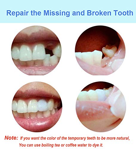 Tooth Filling Thermal Beads Do it Yourself Moldable False Teeth for Temporary Tooth Repair the Missing and Broken Tooth Replacement Kit(2 pack)