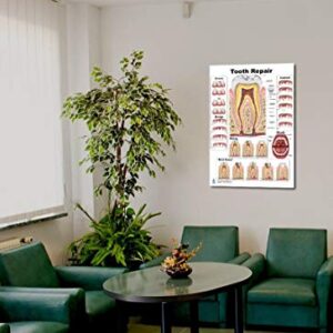 Tooth Repair Poster, Chart (PVC, Large 24x36)