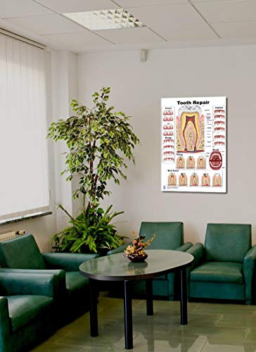 Tooth Repair Poster, Chart (PVC, Large 24x36)