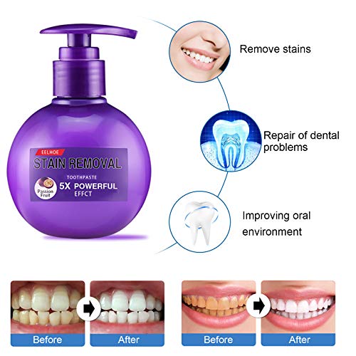 FREEORR 2Pcs Intensive Stain Removal Gel Toothpaste, Purple Toothpaste for Teeth, Fresh Breath Oral Care, More Hygienic and Durable Pump Design Toothpaste