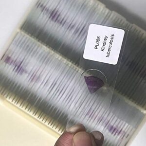 Human Pathological Section Prepared Tissue Specimen Slides 100pcs/box