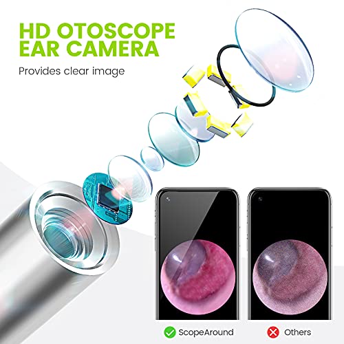 Ear Wax Removal Camera for Android Phone Tablet, Mac, PC, 1280x720HD Smart Visual Ear Cleaner with Camera Tool Kit, at Home Ear Infection Detector Ear Wax Remover Otoscope with Light