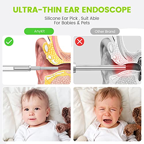 Ear Wax Removal Camera for Android Phone Tablet, Mac, PC, 1280x720HD Smart Visual Ear Cleaner with Camera Tool Kit, at Home Ear Infection Detector Ear Wax Remover Otoscope with Light