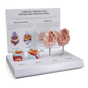 gpi anatomicals - anatomy model of human respiratory system with chronic obstructive pulmonary disease (copd), bronchus and alveoli models for anatomy and physiology education, medical study supplies