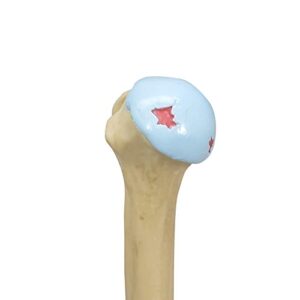 GPI Anatomicals Shoulder Joint Model Set | Human Body Anatomy Replica Set of 4-Stage Osteoarthritis Shoulder Joint for Doctors Office Educational Tool