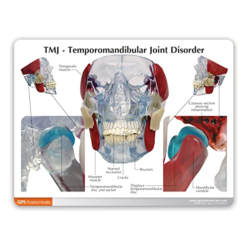 GPI Anatomicals - Temporomandibular Joint (TMJ) Model, Replica with Pathologies for Human Anatomy and Physiology Education, Anatomy Model for Doctor's Offices and Classrooms, Medical Study Supplies