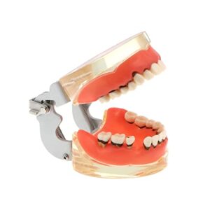 dental teeth typodonts model for parodontopathy periodontal disease, removable gingivae pathology teeth model used in teaching,explain,studying for adult(transparent)
