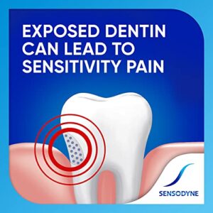 Sensodyne Extra Whitening Sensitive Teeth Whitening Toothpaste - 4 Ounces (Pack of 3)