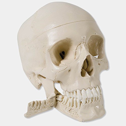 Wellden Medical Anatomical Skull Model, 4-Part, with Lower Jaw 16 Teeth Extractable