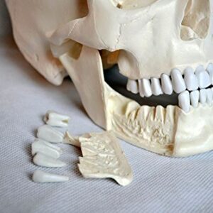 Wellden Medical Anatomical Skull Model, 4-Part, with Lower Jaw 16 Teeth Extractable