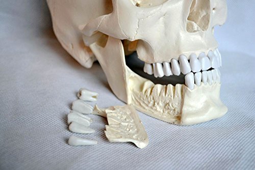 Wellden Medical Anatomical Skull Model, 4-Part, with Lower Jaw 16 Teeth Extractable