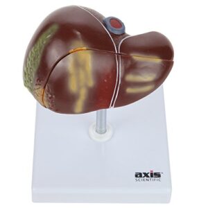 axis scientific anatomy model of diseased liver | model is 1/3 life-size and divides in 2 parts | shows 6 liver diseases and abnormalities | comes on a white base