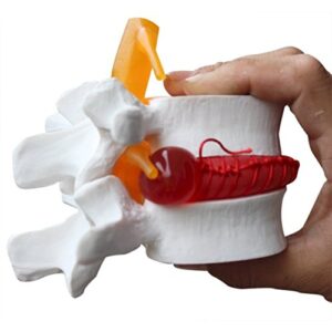 bonew-oral 1:1.5 anatomical human lumbar vertebrae degenerative lumbar human spine model white color