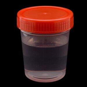 YXQ 20Pcs 120ML Sterile Specimen Cups with Lids 3OZ Screw-on Cap Red Cover Measuring Containers Seal Clear Transparent PP-Plastic