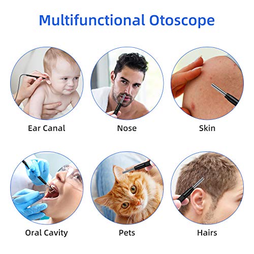Jiusion 3.9mm Ultra-Thin Portable USB Digital Otoscope Camera with Carrying Case, HD 720P 6 LED Visual Ear Scope with 3 Hats 2 Silicone Caps 8 Earwax Spoons for Android Windows Mac NOT for iPhone iPad