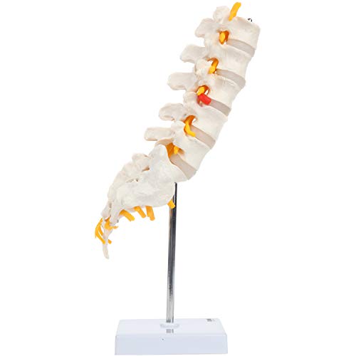 Axis Scientific Lumbar Spine Anatomy Model with Sacrum and Spinal Nerves, Lumbar Vertebrae, Vertebral Model, Spinal Model Didactic Replica of Lumbrosacral Section with Nerves, Herniated Disc at L4, Includes Base for Display