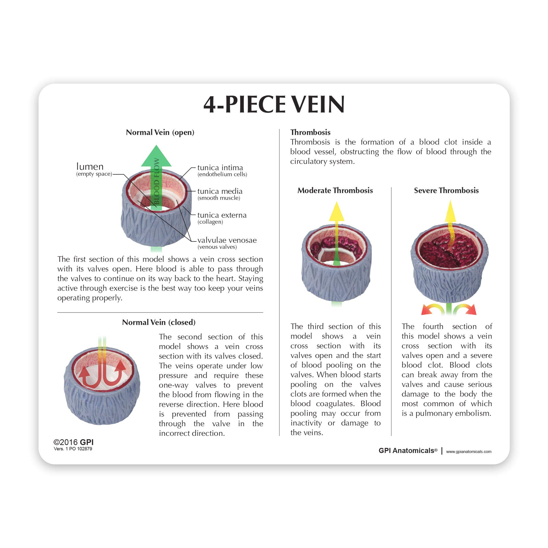 GPI Anatomicals - 4-Piece Vein Model | Human Body Anatomy Replica of Vein w/Blood Clot for Doctors Office Educational Tool