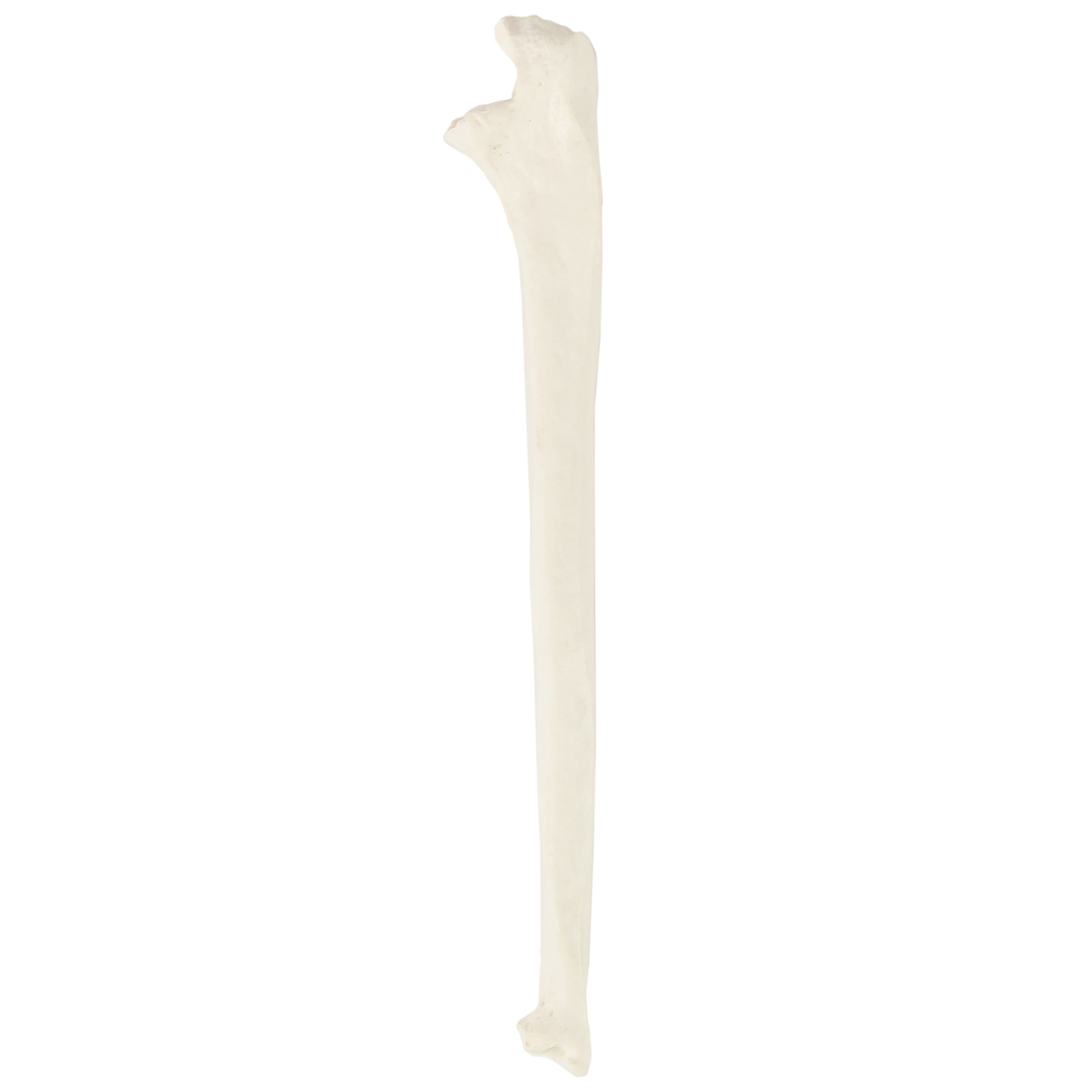 Axis Scientific Ulna Bone Model | Left | Cast from a Real Human Ulna Bone l Forearm Bone Model Has Realistic Texture and Important Bony Landmarks