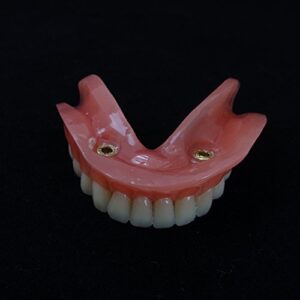 Smile1000 Dental Model Overdenture Inferior 2 Implants Demo for Studing and Teaching