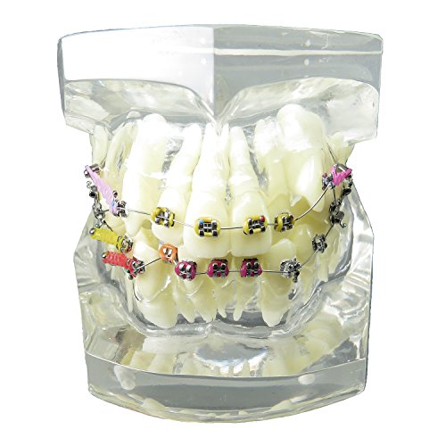 Smile1000 Dental Malocclusion Orthodontic Treatment Teeth Model with Metal Brackets Wires Colorful Ties Chains and Hoops M3005