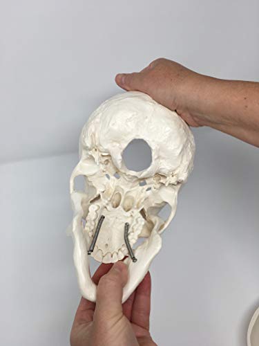 Medical Anatomical Skull Model - 3 Parts - Life Sized Human Mold