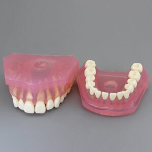 Dental Implant Teeth Model Study Teach Standard Model with Removable Teeth