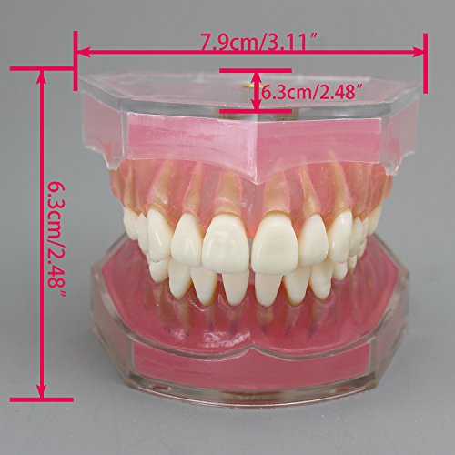 Dental Implant Teeth Model Study Teach Standard Model with Removable Teeth