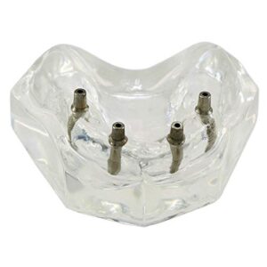 DENTALMALL Dental Upper Implants Model Overdenture with 4 Superior Teeth Demo Transparent Vision for Education and Study Model Tool M6001 C