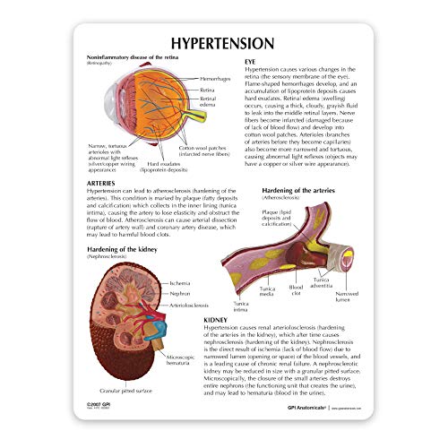 GPI Anatomicals - Hypertension Model Set | Human Body Anatomy Replica of The Effects from High Blood Pressure for Doctors Office Educational Tool