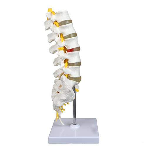 Vision Scientific VAV262 Medical Grade, Articulated Lumbar Spinal Column | Features 5 Lumbar/Vertebrae with Intervertebral Discs, Lumbar Nerves and Spinal Cord | Instruction Manual