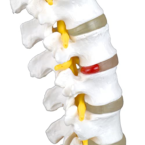 Vision Scientific VAV262 Medical Grade, Articulated Lumbar Spinal Column | Features 5 Lumbar/Vertebrae with Intervertebral Discs, Lumbar Nerves and Spinal Cord | Instruction Manual