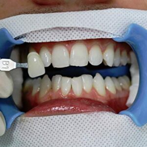 BEYOND FLEXIBLUE Comfort Cheek Retractors | Disposable Dental Cheek Retractors | Plastic Mouth Opener - Medium 10pk
