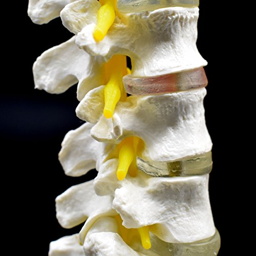 Medical Human Lumbar Spine Demonstration Model Anatomical Model Lumbar Vertebrae Sacrum & Coccyx, with Herniation Disc,for Science Classroom Study Display Teaching Medical Model 15 Inch Hight