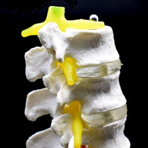 Medical Human Lumbar Spine Demonstration Model Anatomical Model Lumbar Vertebrae Sacrum & Coccyx, with Herniation Disc,for Science Classroom Study Display Teaching Medical Model 15 Inch Hight