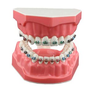 dentalmall typodonts orthodontics demonstration model with metal wires and bracket teaching, learning, interpretation model for adults and children (metal bracket)
