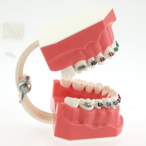 Dentalmall Typodonts Orthodontics Demonstration Model with Metal Wires and Bracket Teaching, Learning, Interpretation Model for Adults and Children (Metal Bracket)